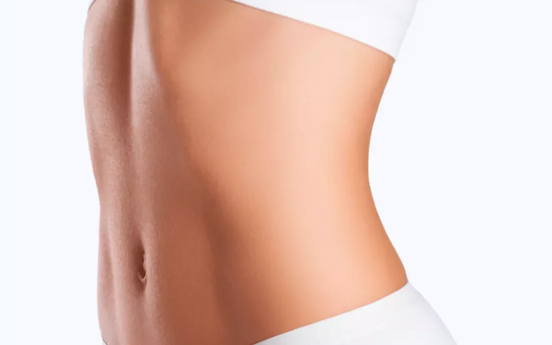 Abdominoplastia