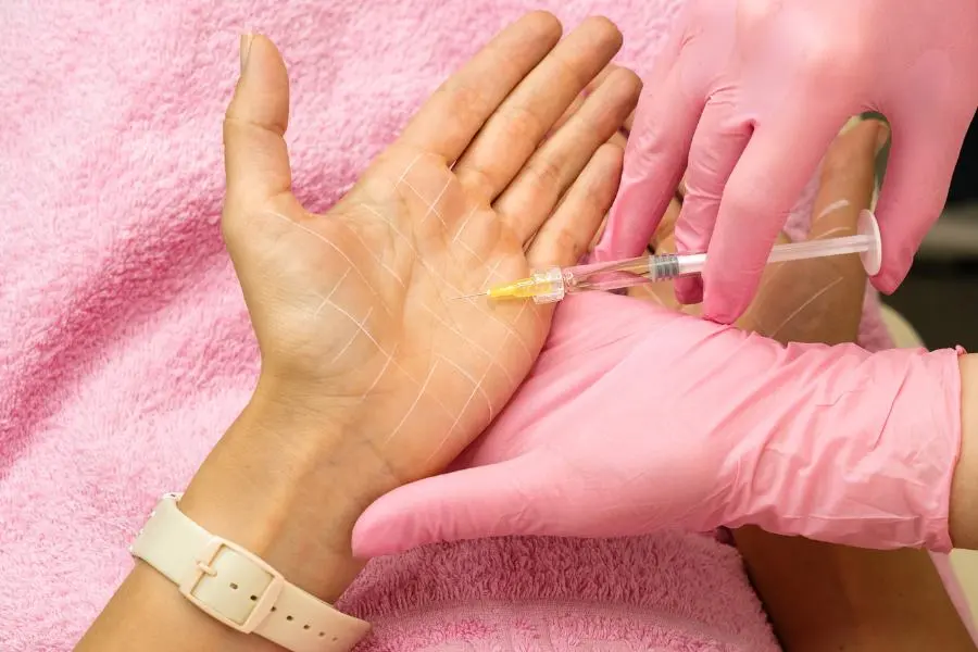 hiperhidrosis-de-manos-compressed Tratamiento de neuromodulador para bloquear el sudor de la hiperhidrosis palmar.
