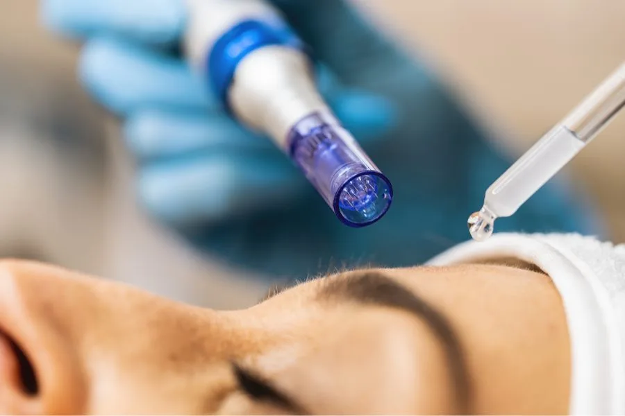 dermapen-facial-compressed